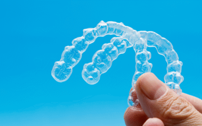 CHOOSING INVISALIGN: HOUSTON SPECIALIST
