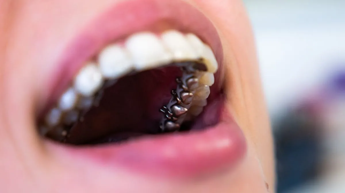 Aparatos ortopédicos Incognito en Houston