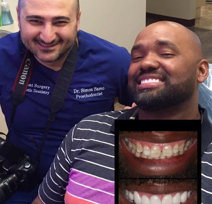 An Extreme Smile Makeover For The New Year | Houston, TX