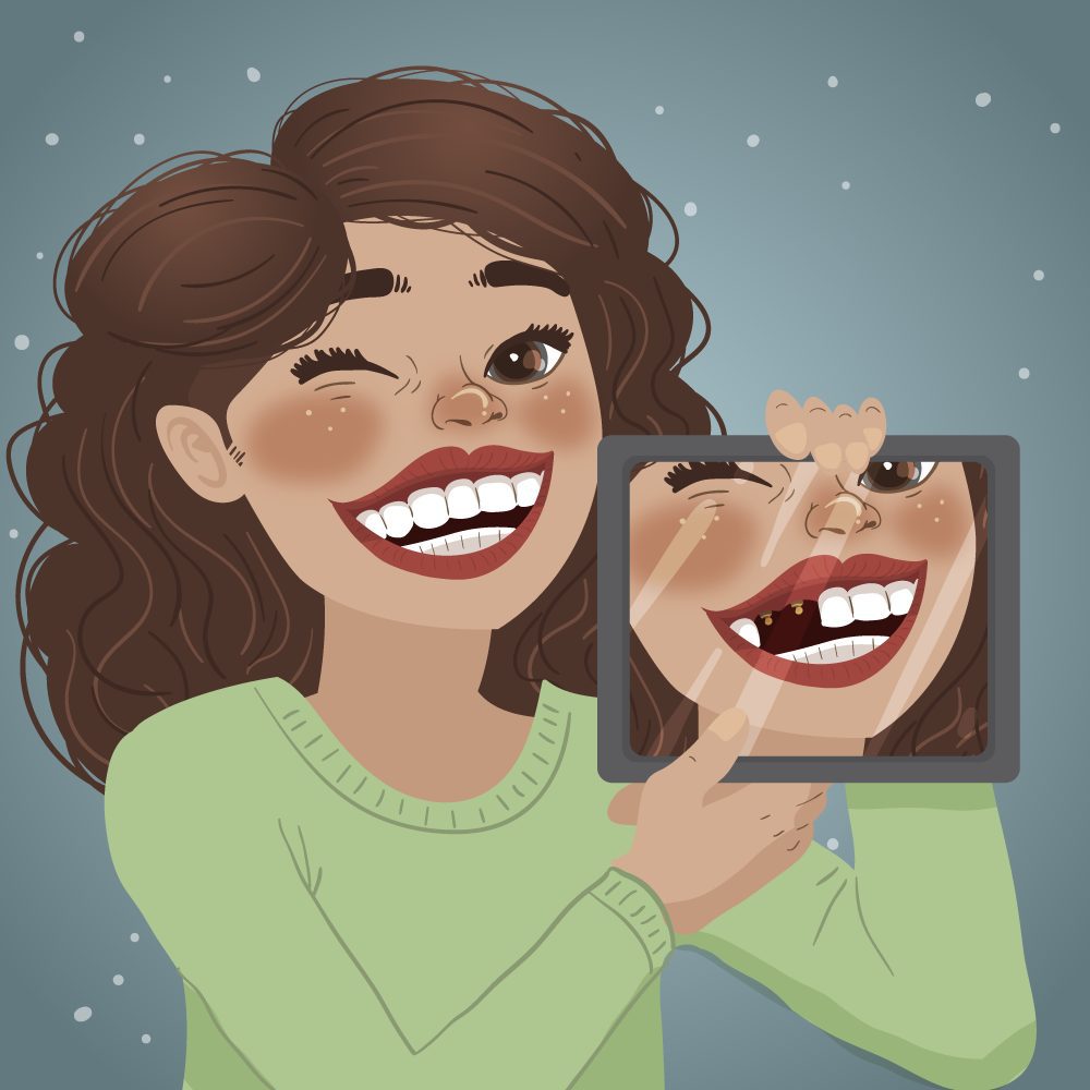 Types of dental implants Types of dental implants