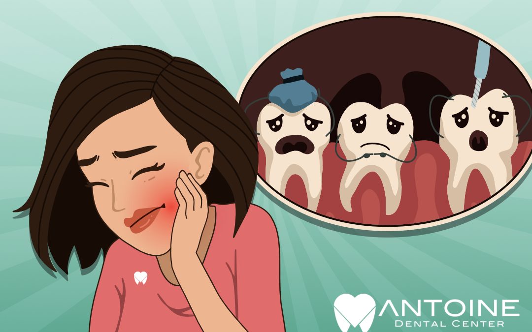 Root Canal Houston