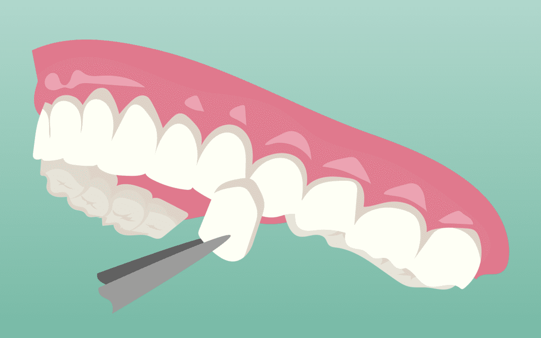 Affordable Cosmetic Dentistry in Houston, TX