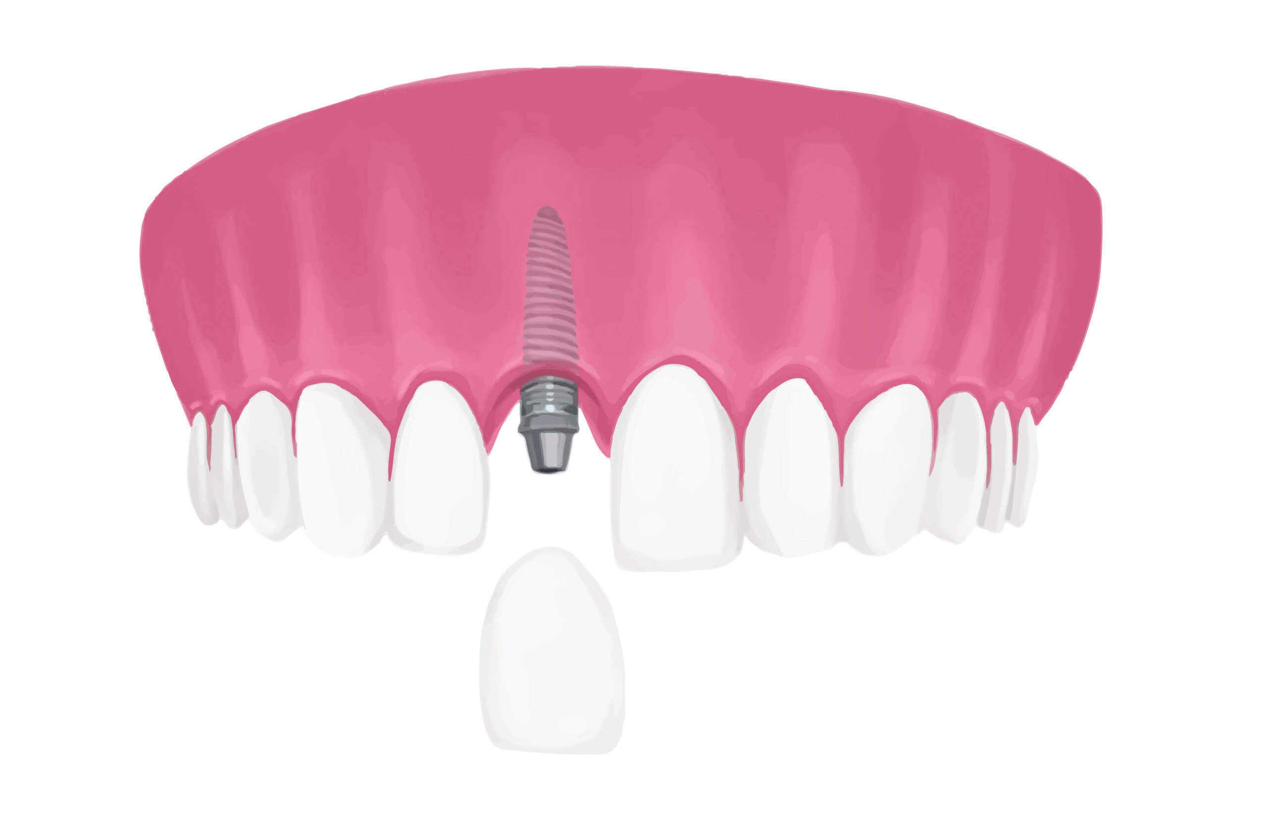 dental care oral hygiene
