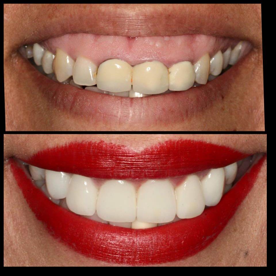 cosmetic dentistry