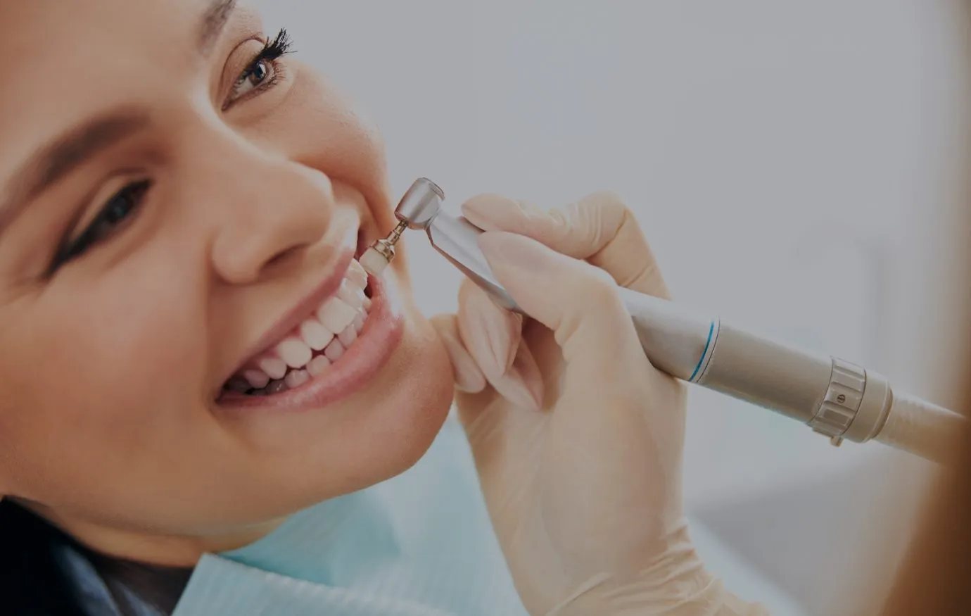 teeth cleaning in Houston