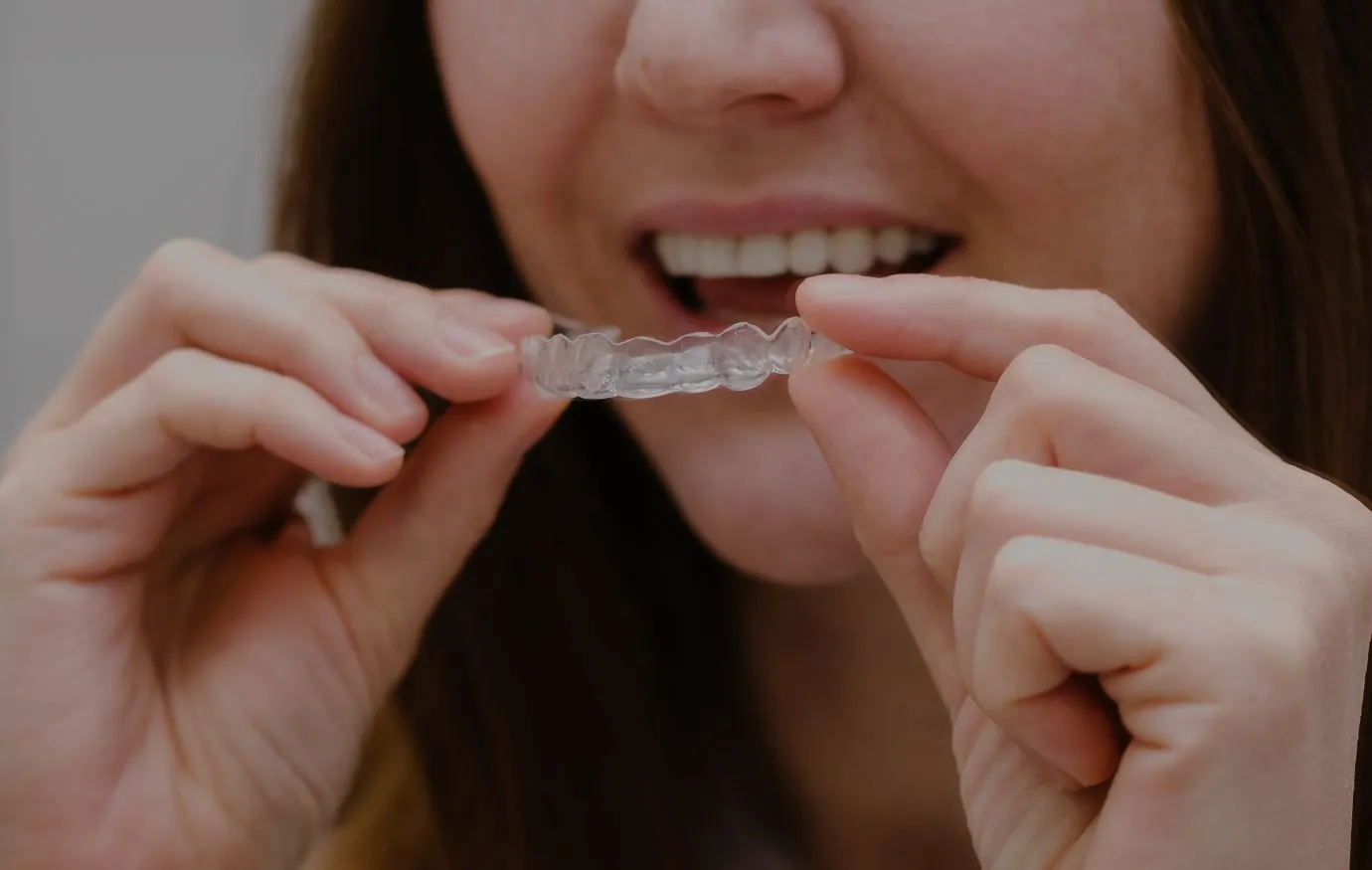 invisalign in Houston
