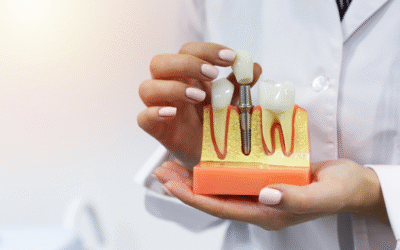 Dental Implants near me