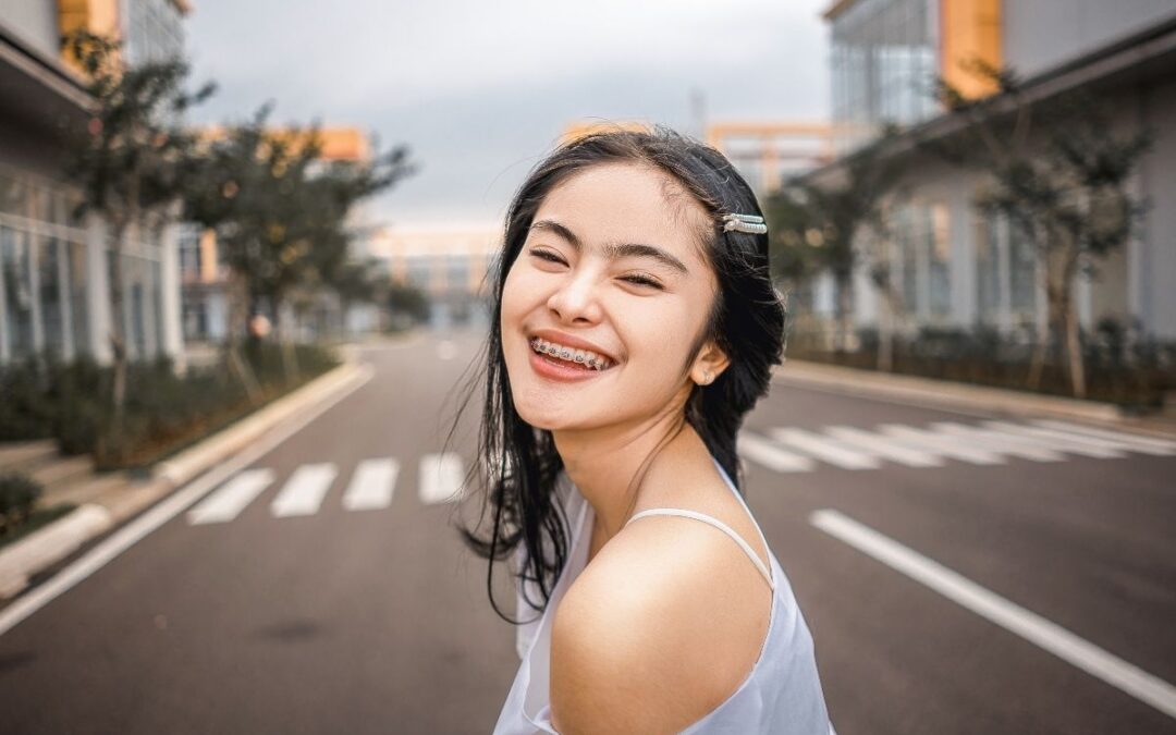 Transform Your Smile with Braces in Downtown Houston