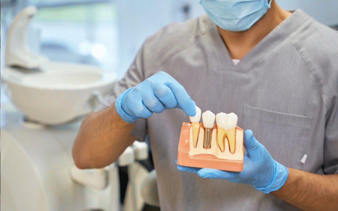 Bring Back Your Smile with Dental Implants in North Houston