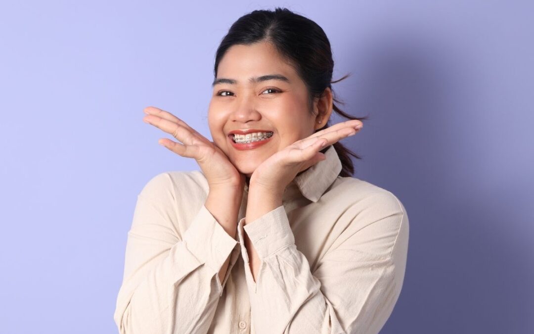 The Cost of Braces in Houston — What Affects It?
