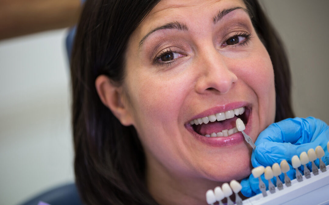 same-day dental implants in Houston