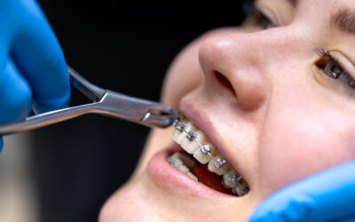 Why Orthodontic Treatment in Houston Is More Accessible Than Ever