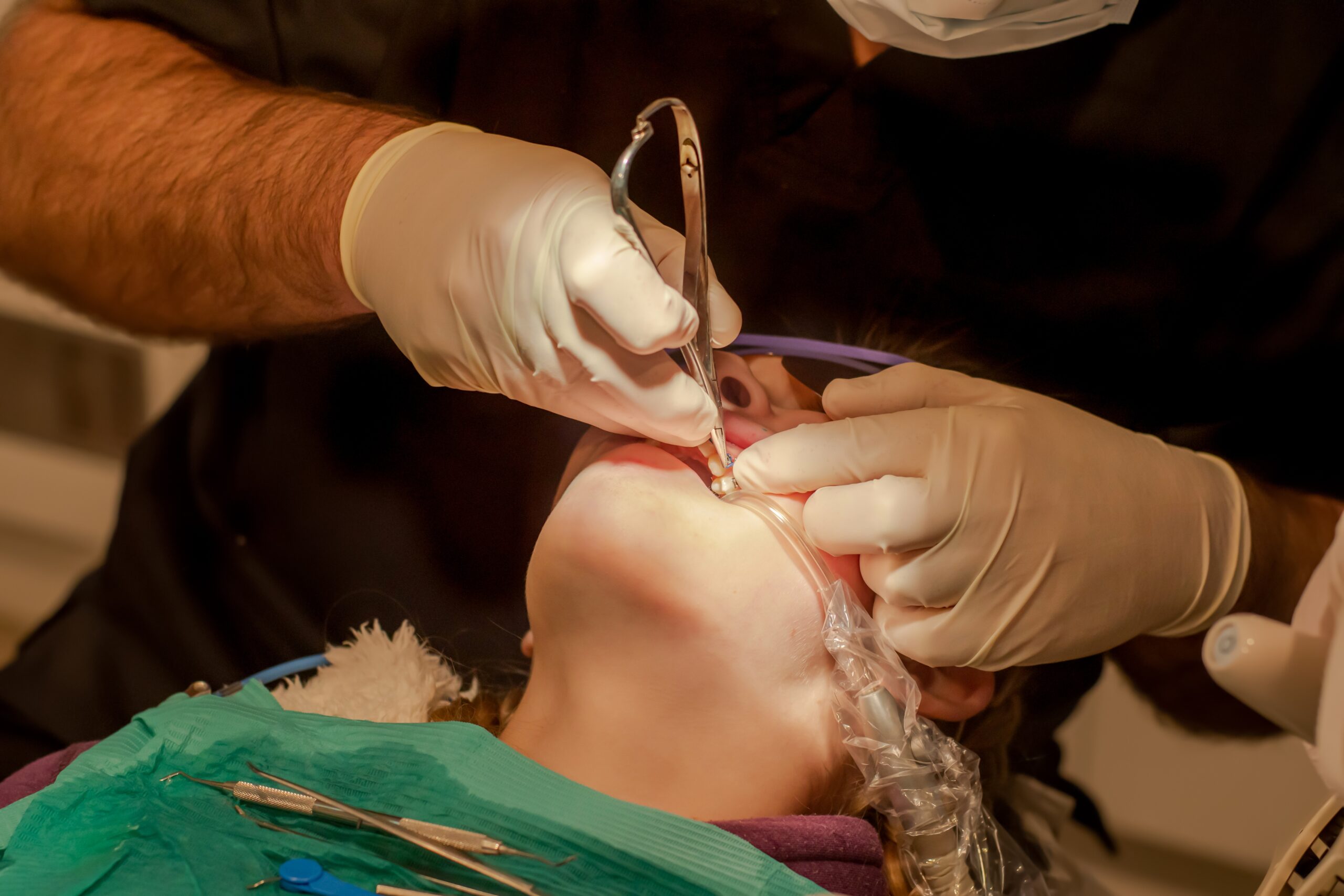 Dental Bridges Houston