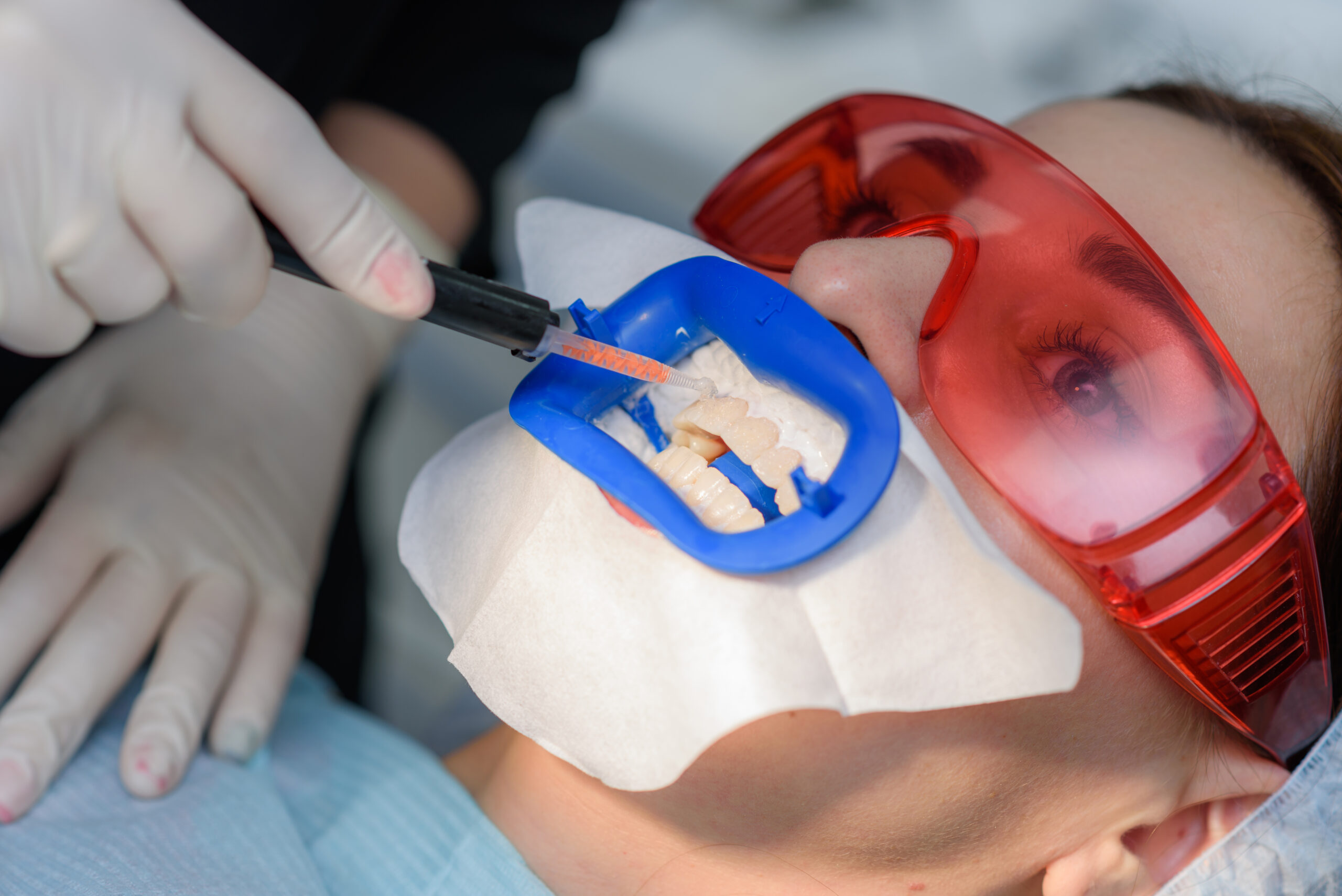 Dental Bridges Houston