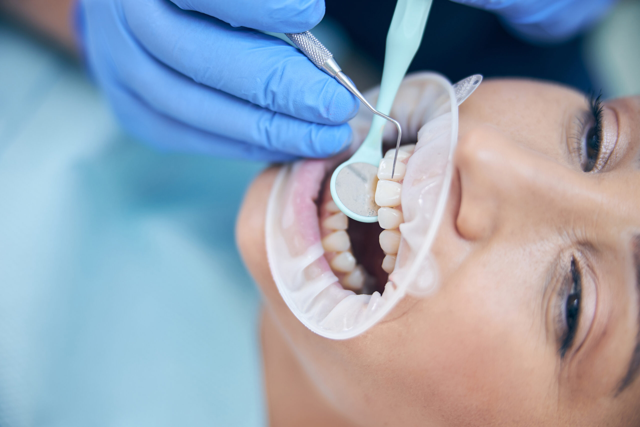 Dental Bridges Houston