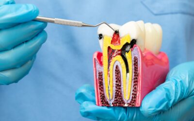 Root Canal Post-Op Instructions: How to Care for Your Tooth After Treatment
