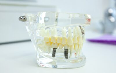 Restore Your Smile with Invisalign in Houston and Advanced Dental Implant Solutions