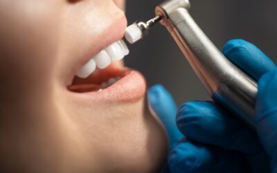 Why Houston Patients Choose Antoine Dental Center for Quality Dental Care