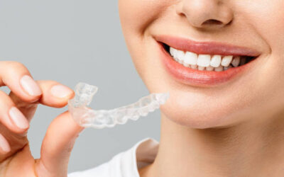 Your Guide to a Straighter Smile – Modern Dental Solutions in Houston