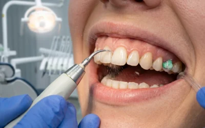 Signs Your Child Is Due for a Professional Dental Cleaning